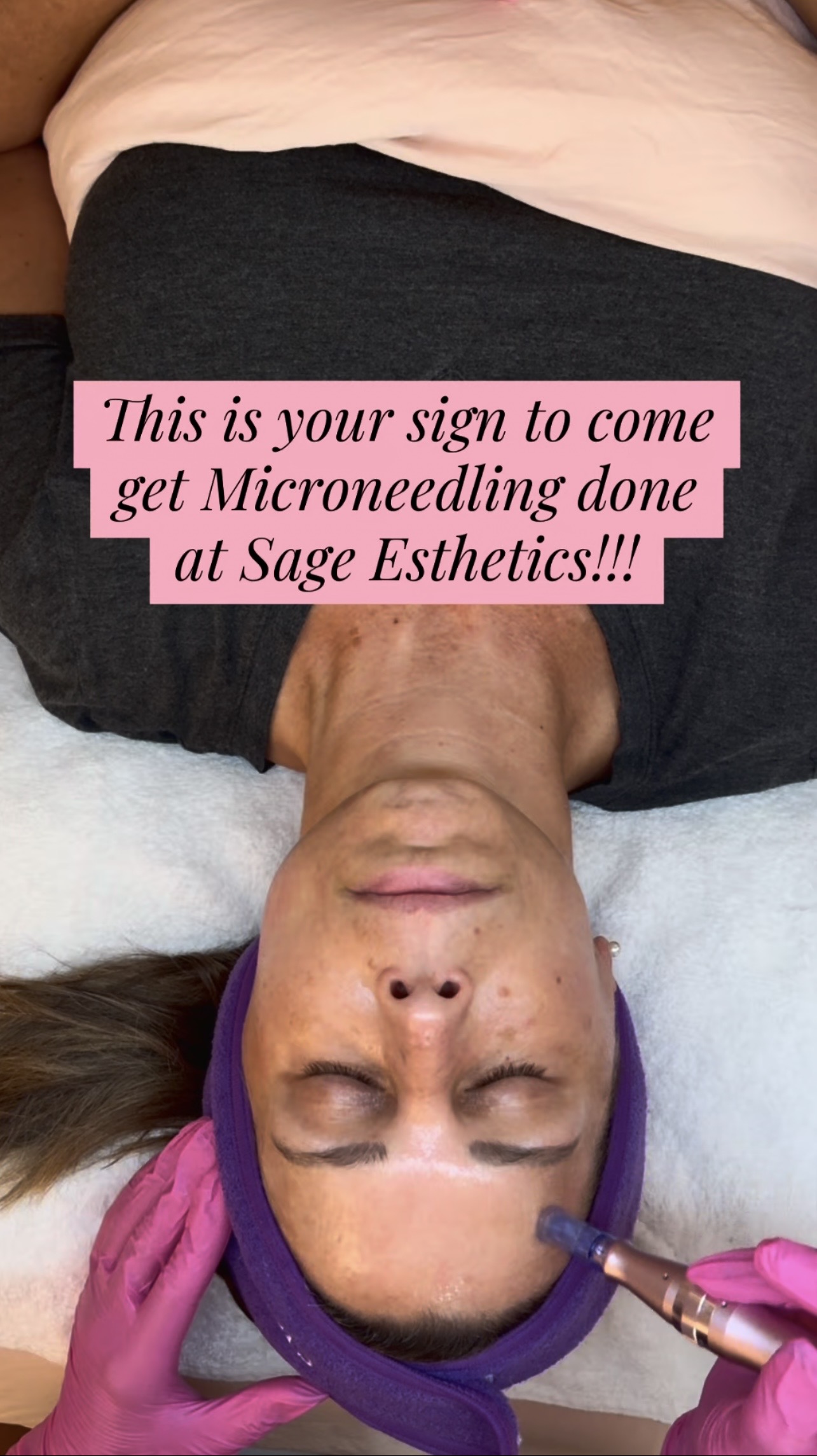 Micro needling Treatment