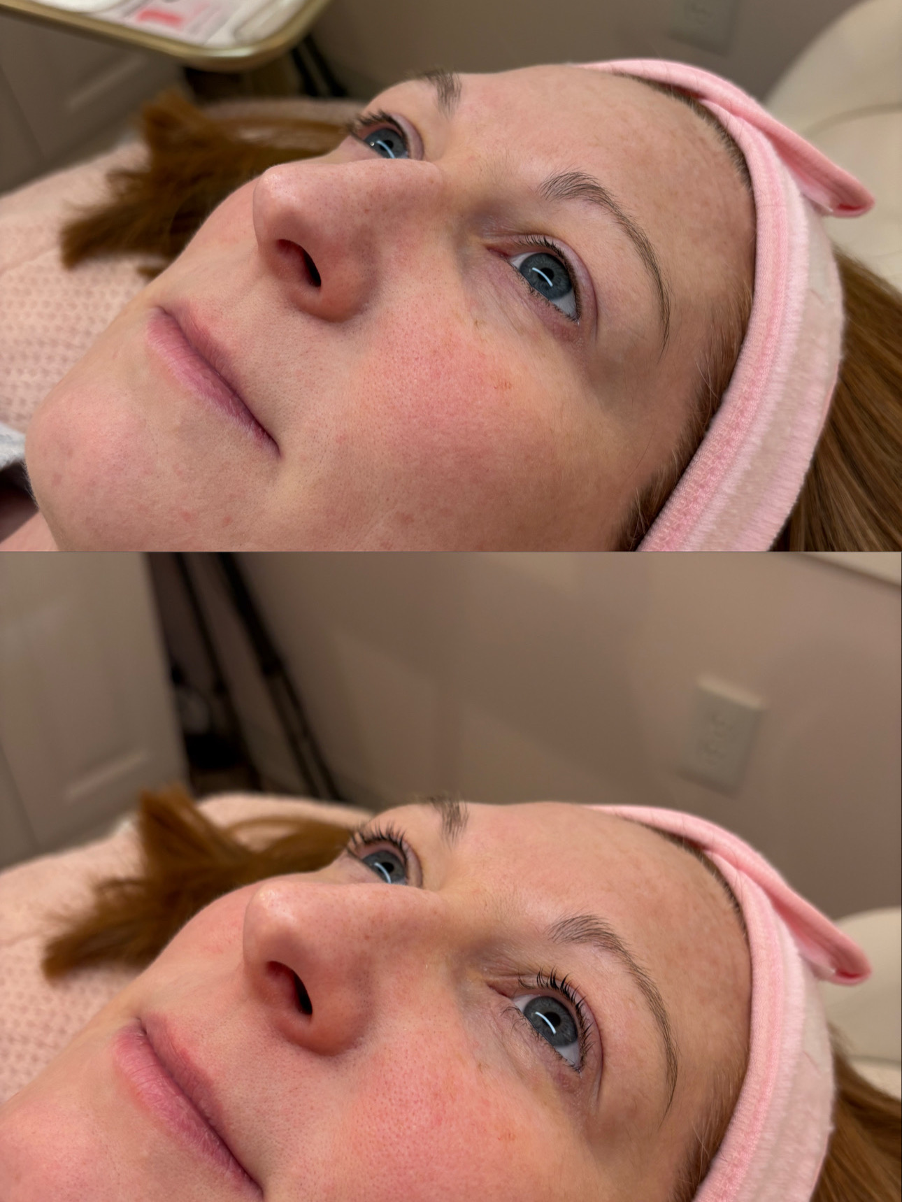 Lash Lift